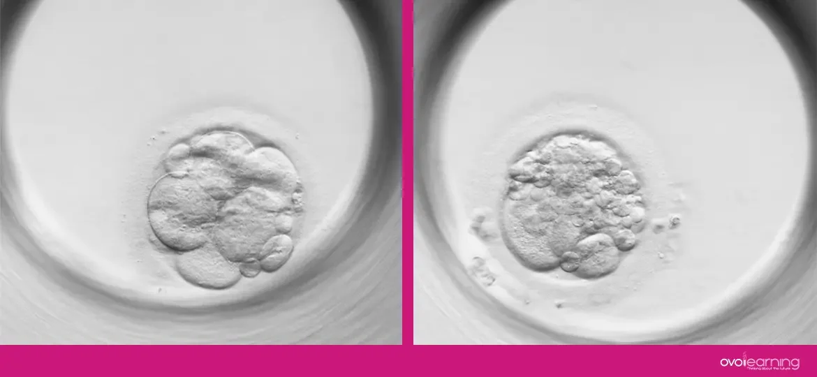 embryonic fragmentation