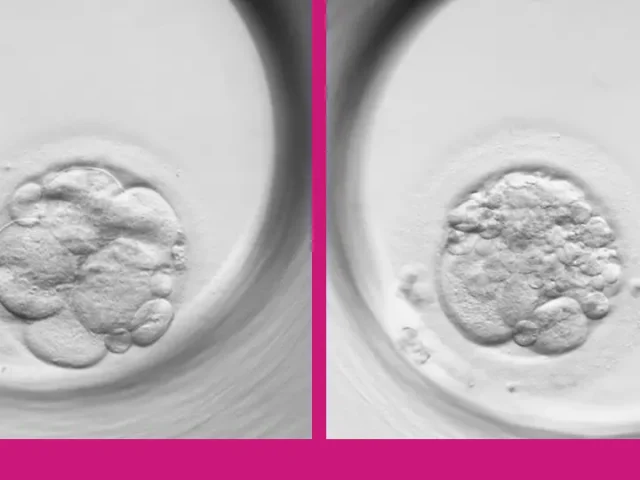 embryonic fragmentation