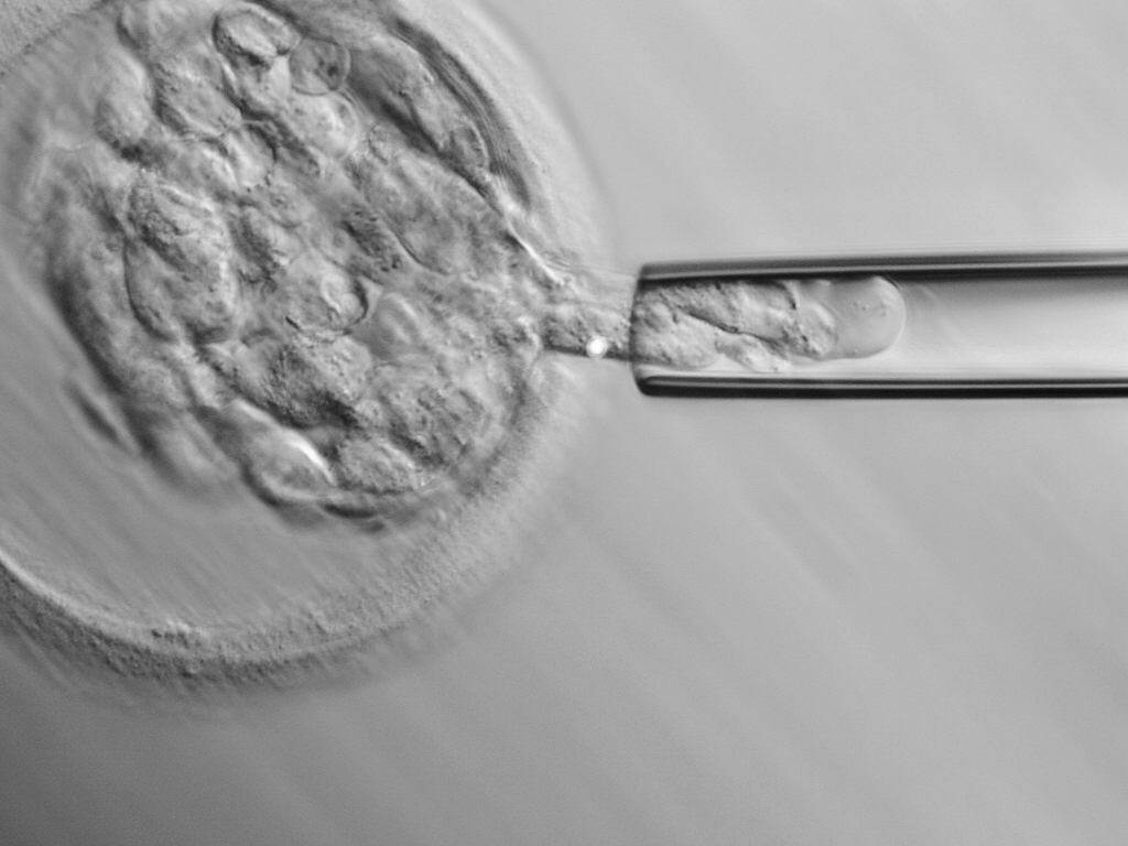 DGP-biopsia blastocisto (1) edit (2)